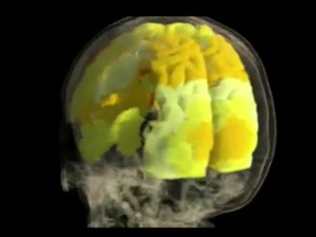 രതിമൂര്‍ച്ഛസമയത്ത് തലച്ചോറില്‍  നടക്കുന്നതെന്ത്?