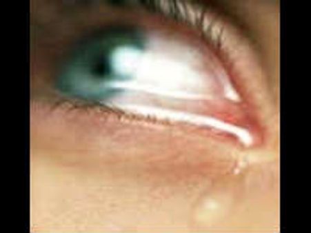 அழுது 'காரியம்' சாதிப்பதில் ஜெகஜால கில்லாடிகள்-ஆண்களே!